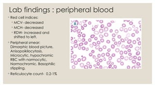 mchc anemia seminar.pptx mchc anemia seminar.pptx
