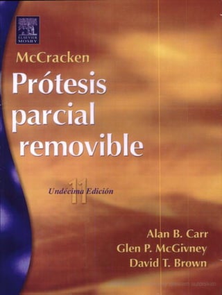 Prótesis Parcial Removible- Mckraken