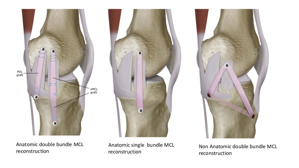 MCL,LCL & ALL injuries of the knee