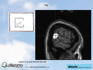 Fig.




                                   Castelli F et al. Brain 2002;125:1839-1849


©2002 by Oxford University Press
 