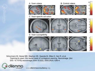Schurmann M, Hesse MD, Stephan KE, Saarela M, Zilles K, Hari R, et al.
   Yearning to yawn: the neural basis of contagious yawning. Neuroimage. [doi:
   DOI: 10.1016/j.neuroimage.2004.10.022]. 2005;24(4):1260-4.
 