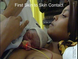 UNICEF/WHO Breastfeeding Promotion and Support in a Baby-Friendly Hospital – 20 hour Course 2006
First Skin to Skin Contact
5/3
Dr
Nils
Bergman,
Cape
Town,
South
Africa
 