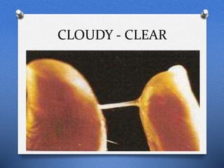 CLOUDY - CLEAR
 
