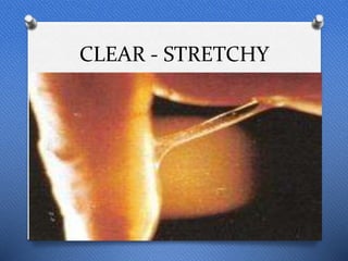CLEAR - STRETCHY
 