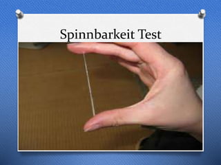 Spinnbarkeit Test
 