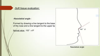 -Soft tissue evaluation:
-Nasolabial angle :
Formed by drawing a line tangent to the base
of the nose and a line tangent to the upper lip
Normal value : 102° ± 8º
Nasolabial angle
 