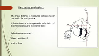 Hard tissue evaluation :
The linear distance is measured between nasion
perpendicular and point A
It determines the antero-posterior orientation of
the maxilla relative to the cranial base
In well-balanced faces :
Mixed dentition = 0
adult = 1mm
 