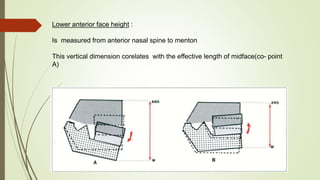 Lower anterior face height :
Is measured from anterior nasal spine to menton
This vertical dimension corelates with the effective length of midface(co- point
A)
 