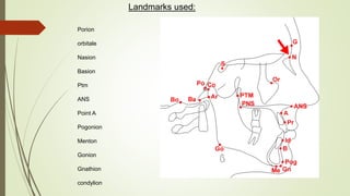 Landmarks used:
Porion
orbitale
Nasion
Basion
Ptm
ANS
Point A
Pogonion
Menton
Gonion
Gnathion
condylion
 