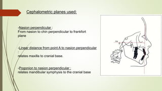 Cephalometric planes used:
-Nasion perpendicular :
From nasion to chin perpendicular to frankfort
plane
-Linear distance from point A to nasion perpendicular
:
relates maxilla to cranial base.
-Pogonion to nasion perpendicular :
relates mandibular symphysis to the cranial base
 