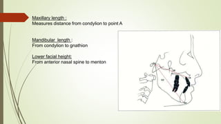 Maxillary length :
Measures distance from condylion to point A
Mandibular length :
From condylion to gnathion
Lower facial height:
From anterior nasal spine to menton
 