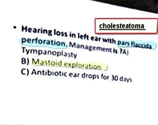"
Hearinglossin leftearwithparsflaccida)
perforation,Managementis?A)
Tympanoplasty
B) Mastoid exploration)
cholesteatoma
C)
Antibioticear drops for 30days
 