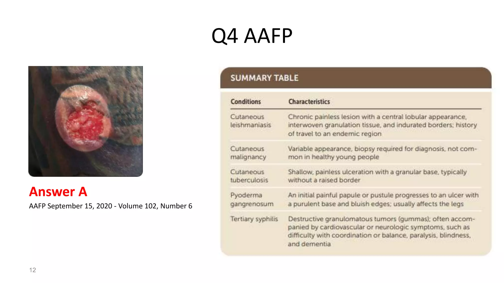 Q4 AAFP
Answer A
AAFP September 15, 2020 - Volume 102, Number 6
12
 
