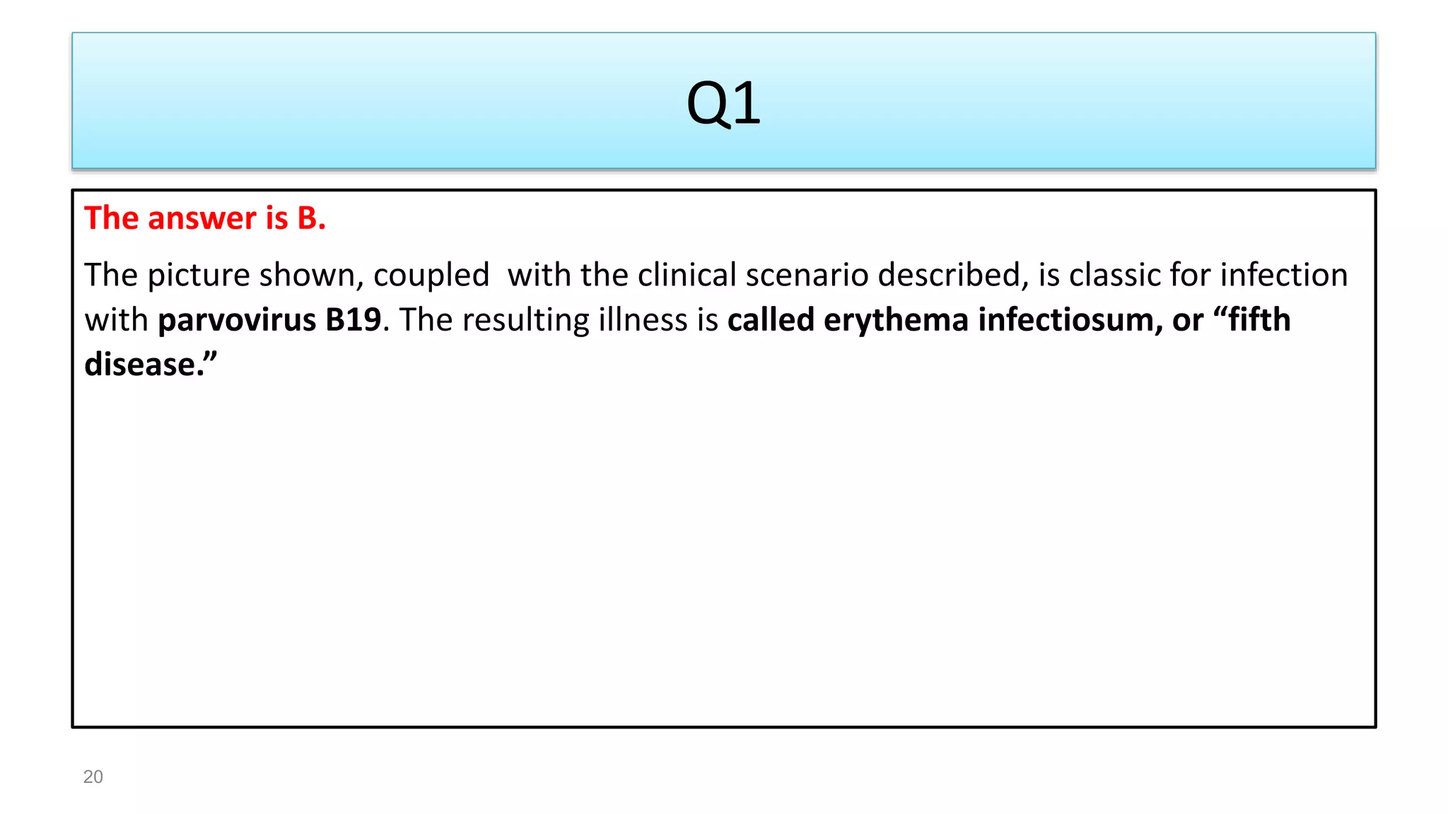 Q1
The answer is B.
The picture shown, coupled with the clinical scenario described, is classic for infection
with parvovirus B19. The resulting illness is called erythema infectiosum, or “fifth
disease.”
20
 
