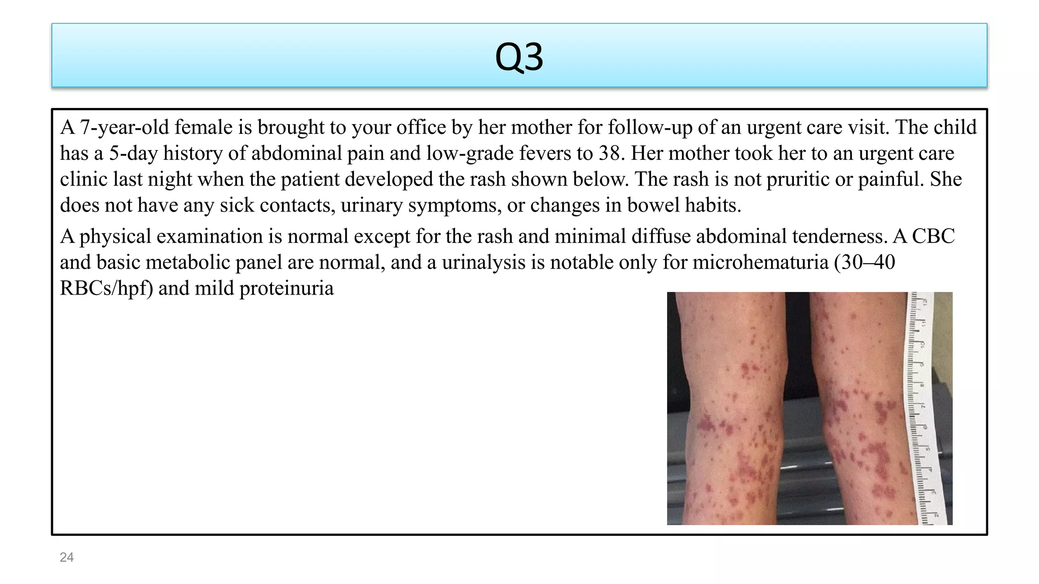 Q3
24
A 7-year-old female is brought to your office by her mother for follow-up of an urgent care visit. The child
has a 5-day history of abdominal pain and low-grade fevers to 38. Her mother took her to an urgent care
clinic last night when the patient developed the rash shown below. The rash is not pruritic or painful. She
does not have any sick contacts, urinary symptoms, or changes in bowel habits.
A physical examination is normal except for the rash and minimal diffuse abdominal tenderness. A CBC
and basic metabolic panel are normal, and a urinalysis is notable only for microhematuria (30–40
RBCs/hpf) and mild proteinuria
 
