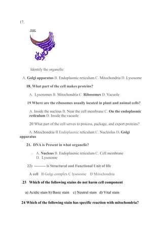 17.
Identify the organelle:
A. Golgi apparatus B. Endoplasmic reticulum C. Mitochondria D. Lysosome
18. What part of the cell makes proteins?
A. Lysosomes B. Mitochondria C. Ribosomes D. Vacuole
19 Where are the ribosomes usually located in plant and animal cells?
A. Inside the nucleus B. Near the cell membrane C. On the endoplasmic
reticulum D. Inside the vacuole
20 What part of the cell serves to process, package, and export proteins?
A. Mitochondria B Endoplasmic reticulum C. Nucleolus D. Golgi
apparatus
21. DNA is Present in what organelle?
o A. Nucleus B. Endoplasmic reticulum C. Cell membrane
D. Lysosome
22) --------- is Structural and Functional Unit of life
A cell B Golgi complex C lysosome D Mitochondria
.23 Which of the following stains do not harm cell component
a) Acidic stain b) Basic stain c) Neutral stain d) Vital stain
24 Which of the following stain has specific reaction with mitochondria?
 