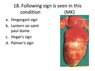 MCQs - Specimens in Obstetrics and Gynaecology | PPTX