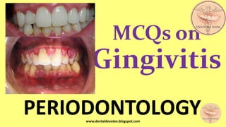 MCQs on
Gingivitis
PERIODONTOLOGYwww.dentaldevotee.blogspot.com
 
