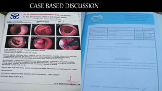 CASE BASED DISCUSSION
 