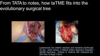 Laparoscopic low anterior resection and transanal pull-through
for low rectal cancer: a Natural Orifice Specimen Extraction
(NOSE) technique. D'Hoore A, Wolthuis AM. Colorectal Dis.
2011 Nov;13 Suppl 7:28-31
From TATAto notes, how taTME fits into the
evolutionary surgical tree
 