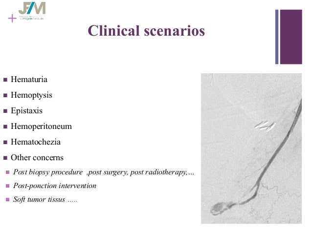 M cuinet hemorrhage in oncologic interventional radiology jfim mumbai…