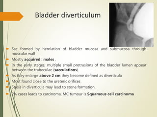 Bladder diverticulum
 Sac formed by herniation of bladder mucosa and submucosa through
muscular wall
 Mostly acquired : males .
 In the early stages, multiple small protrusions of the bladder lumen appear
between the trabeculae (sacculations).
 As they enlarge above 2 cm they become defined as diverticula
 Most found close to the ureteric orifices
 Stasis in diverticula may lead to stone formation.
 2% cases leads to carcinoma, MC tumour is Squamous cell carcinoma
 