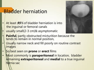 Bladder herniation
• At least 95% of bladder herniation is into
the inguinal or femoral canals
• usually small(2-3 cm)& asymptomatic
• Painful, partly obstructed micturition because the
tends to remain in normal position,
• Usually narrow neck and fill poorly on routine contrast
images
• So best seen on prone or erect films
• Most commonly is paraperitoneal in location, bladder
remaining extraperitoneal and medial to a true inguinal
hernia sac
 