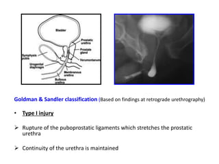 RGU (Retrograde urethrogram), MCU (Micturating cystourethrogram) and ...