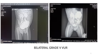 MCU, RGU and their interpretation in abnormalities of urinary bladder ...