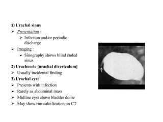 Utricular Cyst Rgu RGU MCU and its interpretation in pathology of Urinary Bladder ...