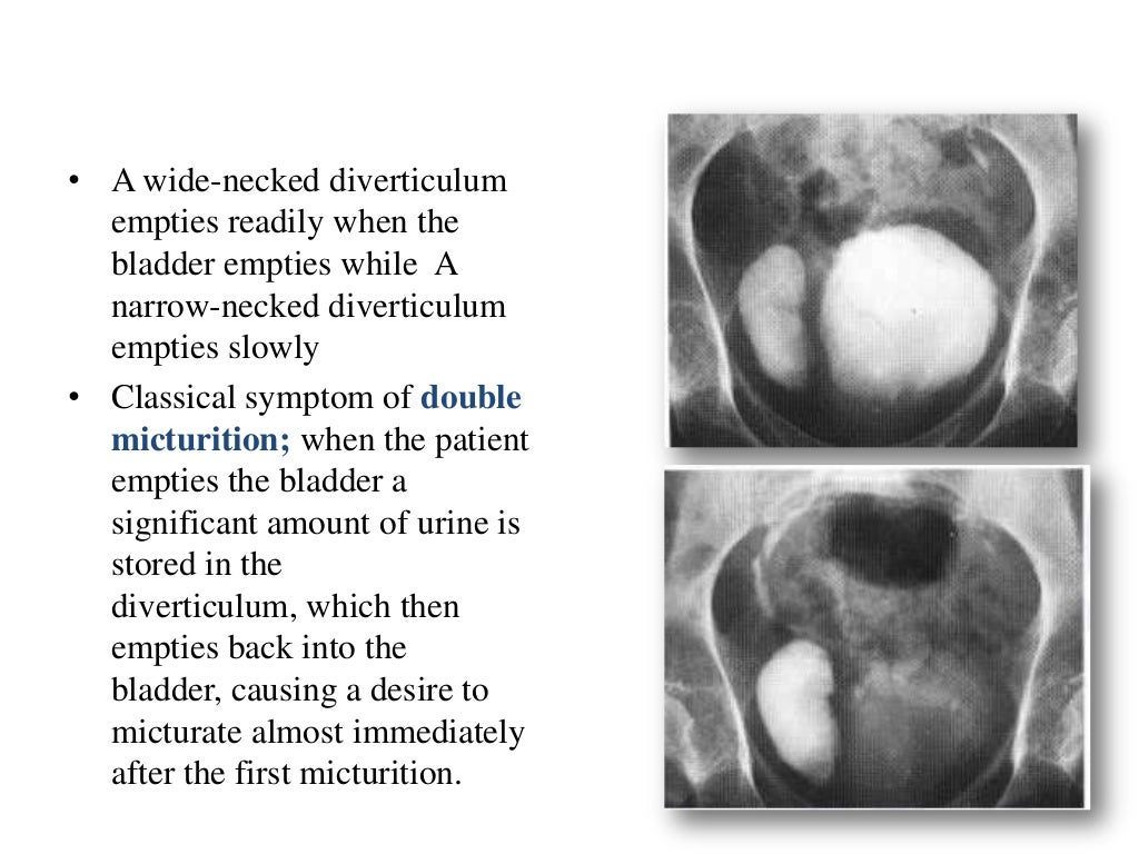 RGU MCU and its interpretation in pathology of Urinary Bladder & Uret…