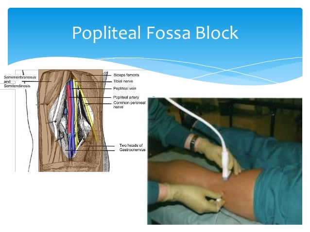 ipack nerve block cpt code