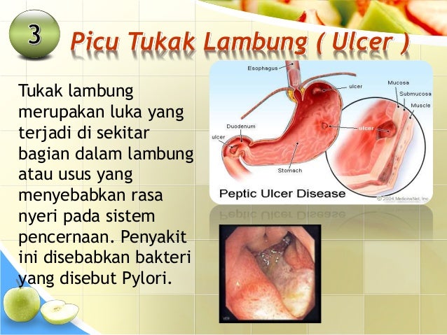 Seminar kesehatan bahaya makanan gorengan bagi kesehatan 