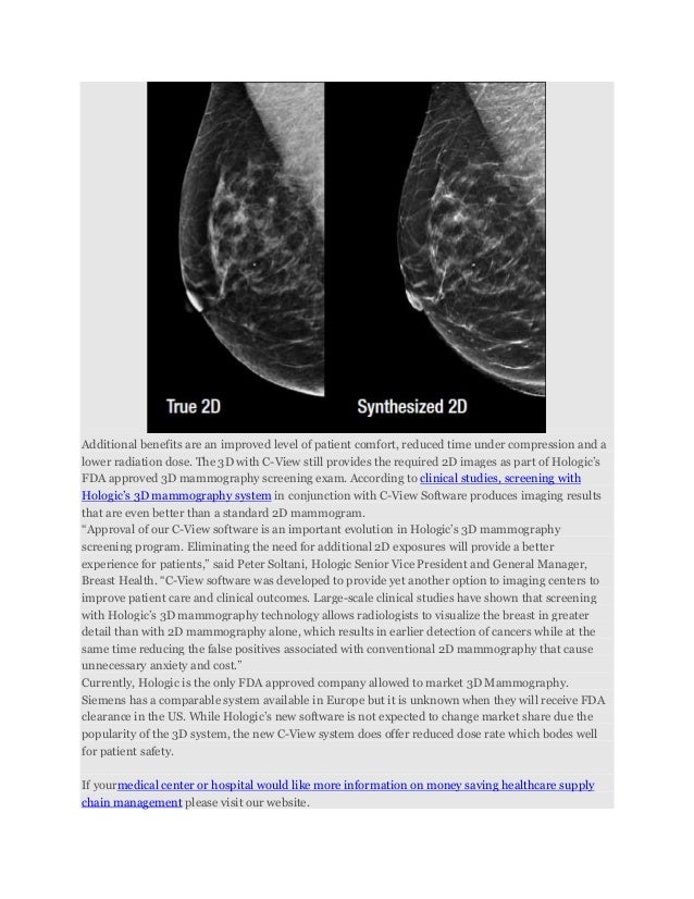 Tomosynthesis fda approval