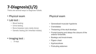 Test For Rickets MD-Ricketsssssssssss 2025(Questi)01h.pdf