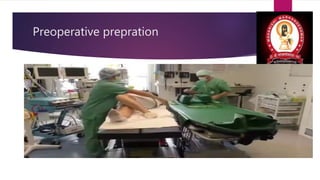 Preoperative prepration
 