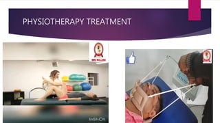 PHYSIOTHERAPY TREATMENT
 