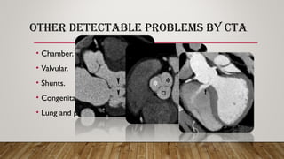 OTHER DETECTABLE PROBLEMS BY CTA
• Chamber.
• Valvular.
• Shunts.
• Congenital anomalies.
• Lung and pulmonary vessels.
 
