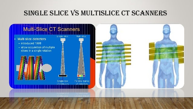 Single Slice Ct Vs Multislice Ct