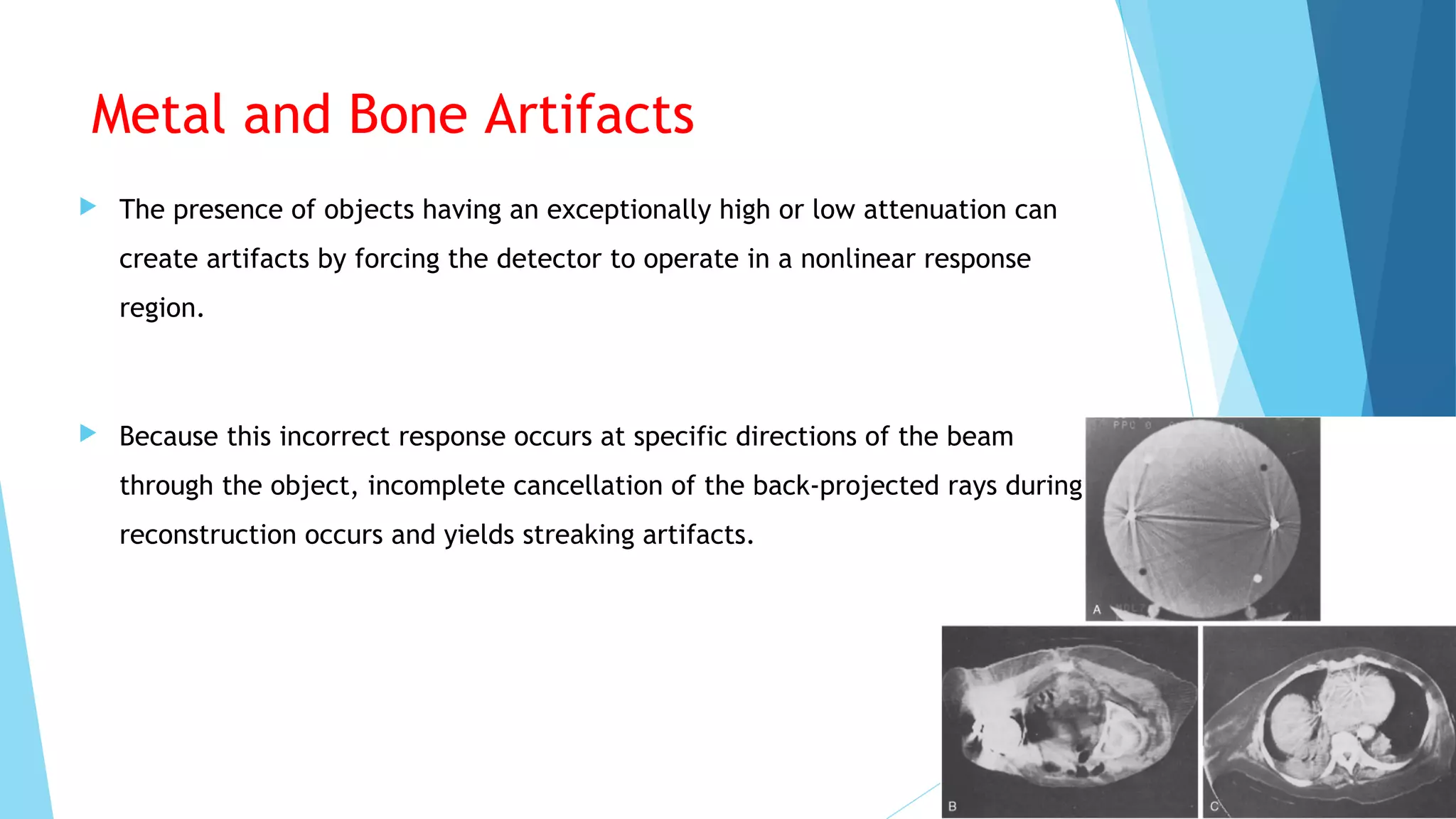Metal and Bone Artifacts
 The presence of objects having an exceptionally high or low attenuation can
create artifacts by forcing the detector to operate in a nonlinear response
region.
 Because this incorrect response occurs at specific directions of the beam
through the object, incomplete cancellation of the back-projected rays during
reconstruction occurs and yields streaking artifacts.
 