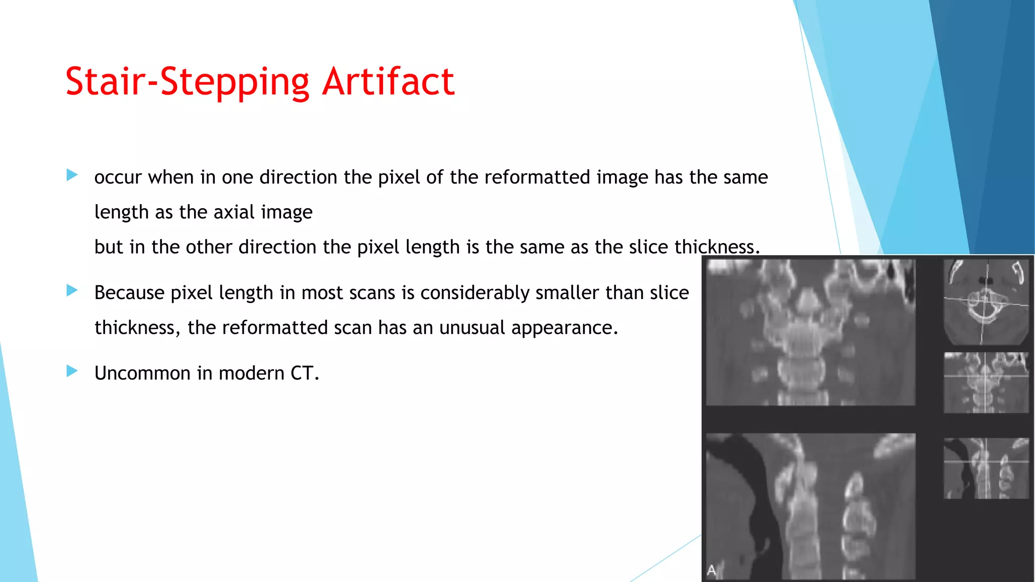Stair-Stepping Artifact
 occur when in one direction the pixel of the reformatted image has the same
length as the axial image
but in the other direction the pixel length is the same as the slice thickness.
 Because pixel length in most scans is considerably smaller than slice
thickness, the reformatted scan has an unusual appearance.
 Uncommon in modern CT.
 