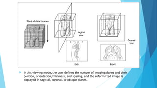  In this viewing mode, the user defines the number of imaging planes and their
position, orientation, thickness, and spacing, and the reformatted image is
displayed in sagittal, coronal, or oblique planes.
 