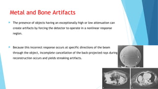 Metal and Bone Artifacts
 The presence of objects having an exceptionally high or low attenuation can
create artifacts by forcing the detector to operate in a nonlinear response
region.
 Because this incorrect response occurs at specific directions of the beam
through the object, incomplete cancellation of the back-projected rays during
reconstruction occurs and yields streaking artifacts.
 