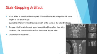 Stair-Stepping Artifact
 occur when in one direction the pixel of the reformatted image has the same
length as the axial image
but in the other direction the pixel length is the same as the slice thickness.
 Because pixel length in most scans is considerably smaller than slice
thickness, the reformatted scan has an unusual appearance.
 Uncommon in modern CT.
 