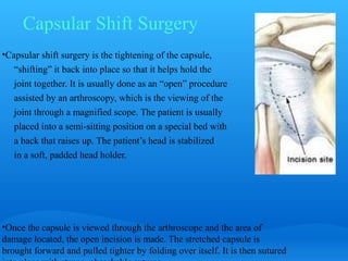 Capsular Shift Surgery
•Capsular shift surgery is the tightening of the capsule,
   “shifting” it back into place so that it helps hold the
   joint together. It is usually done as an “open” procedure
   assisted by an arthroscopy, which is the viewing of the
   joint through a magnified scope. The patient is usually
   placed into a semi-sitting position on a special bed with
   a back that raises up. The patient’s head is stabilized
   in a soft, padded head holder.




•Once the capsule is viewed through the arthroscope and the area of
damage located, the open incision is made. The stretched capsule is
brought forward and pulled tighter by folding over itself. It is then sutured
 