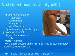 Multidirectional Instability (MDI)

  •Numerous etiologies
     oTraumatic
     oAtraumatic
     oCongenital
     oMultifactorial 
  •Symptomatic global laxity of
glenohumeral joint
  •Generally younger, active        http://test2.aaos.org/oko/topic_images/SPO041.jpg
     o<30
  •Men = Women
  •Orthopedic Research Institute defines as glenohumeral
instability in >1 direction

   •Different from unidirectional instability
 