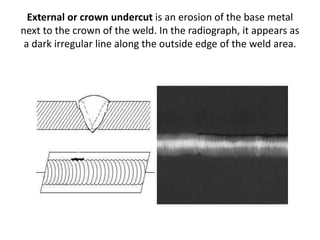 Undercut Radiograph Radiography ndt | PPTX