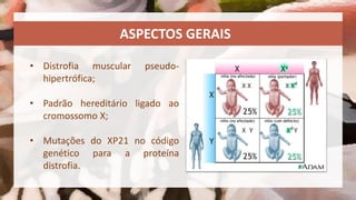 Distrofia Muscular de Duchenne | PPTX
