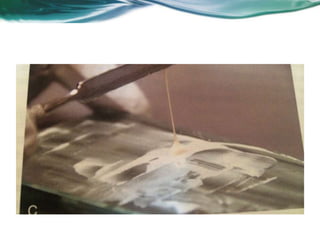 Aula de Revisão MDNM (DP)