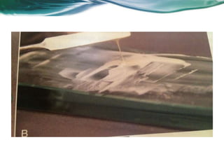 Aula de Revisão MDNM (DP)